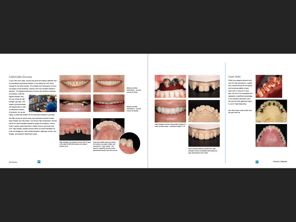 Bay View Dental Lab portfolio, page 22-23.