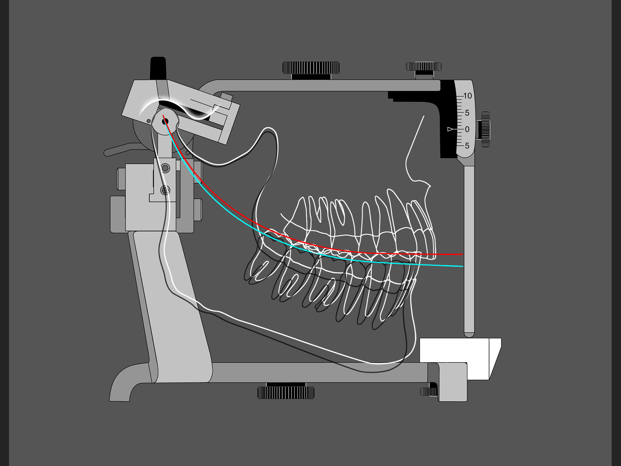 Dental Articulator, Illustrator illustration for slide, 2004.
